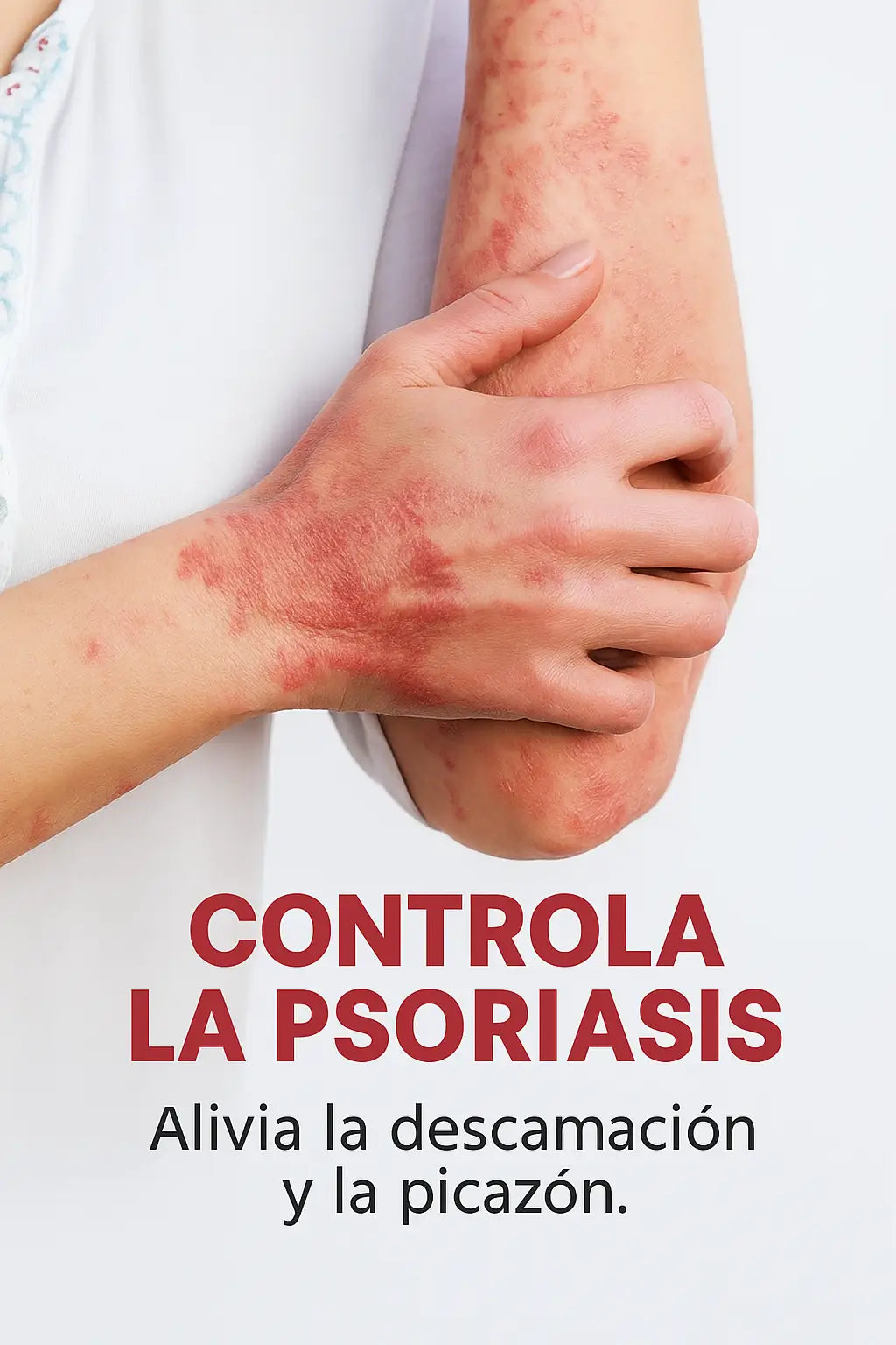SPRAY PSORIASIS 2X1