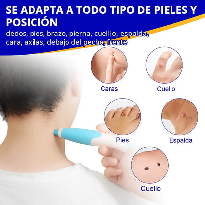 QUITA VERRUGAS CON ACCESORIOS