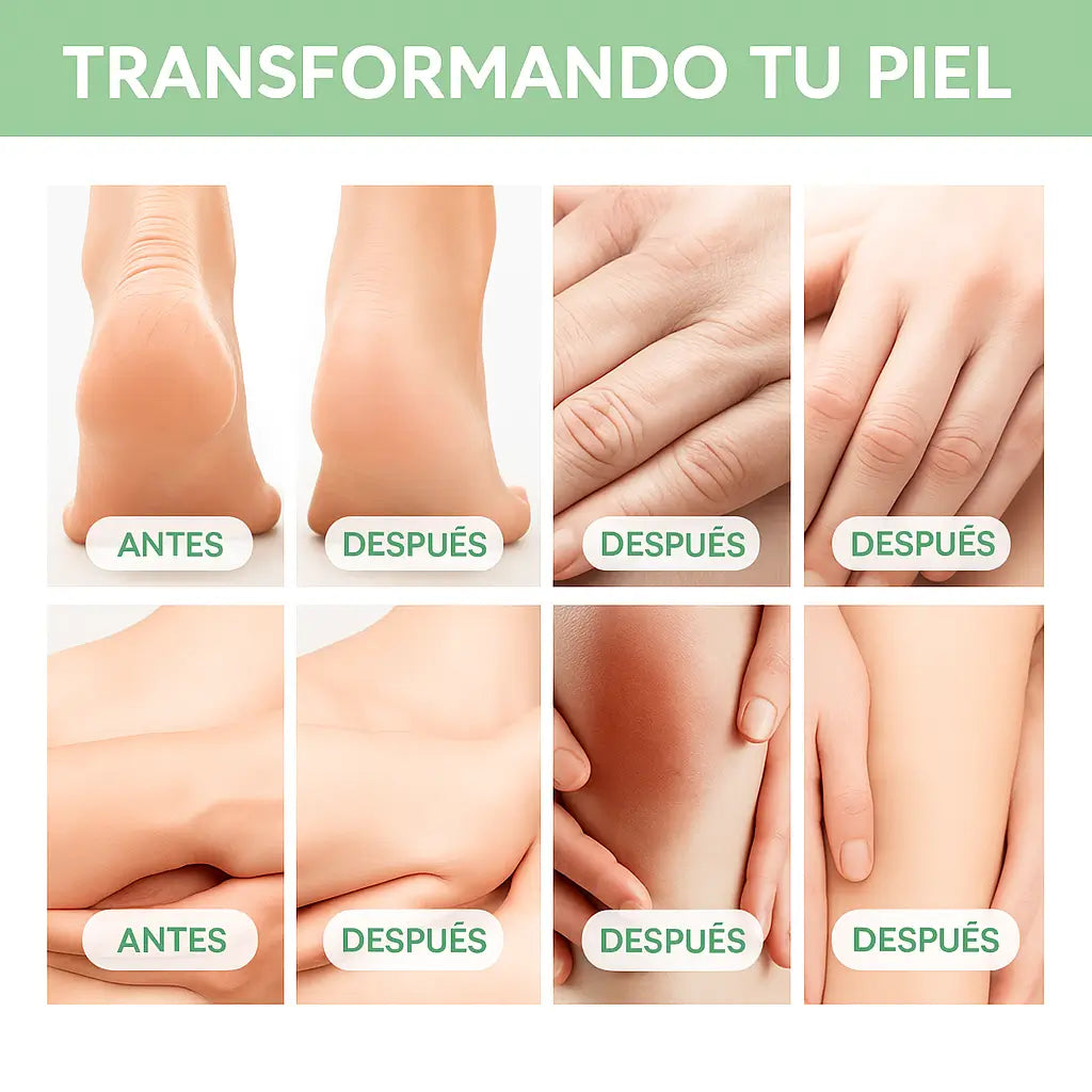 ⭐CREMA UREA AL 40%🍃